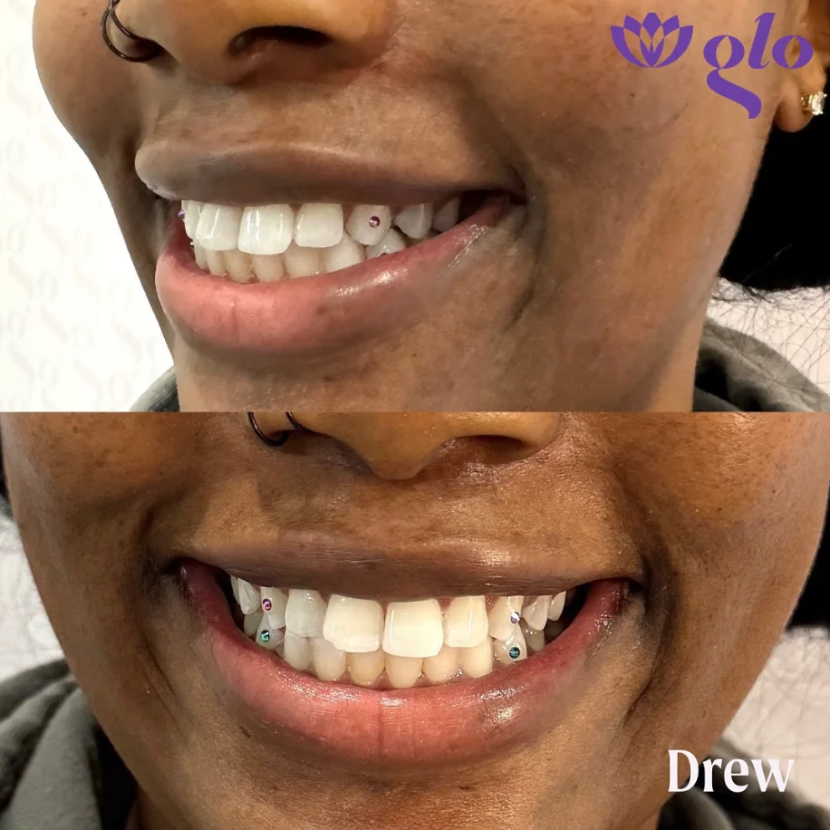 Glo Nail Salon and MedSpa glo nails medspa • Instagram photos and videos 05 20 2025 02 49 PM