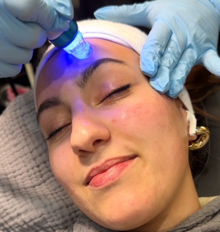 MedSpa Services 16 a woman getting a blue light treatment