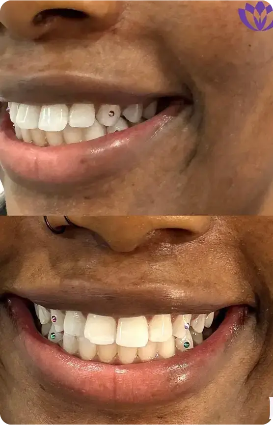 MedSpa Services 85 Image 10 3