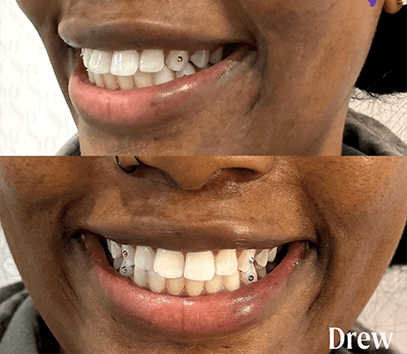 e9ceadfbde2f92a98ac32e2490cdacb8ee291d35 1