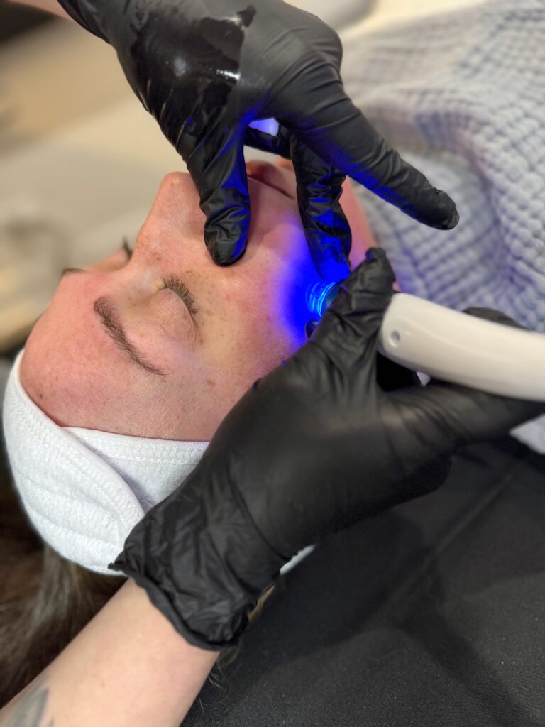 MedSpa Services 17 hydrafacial 1