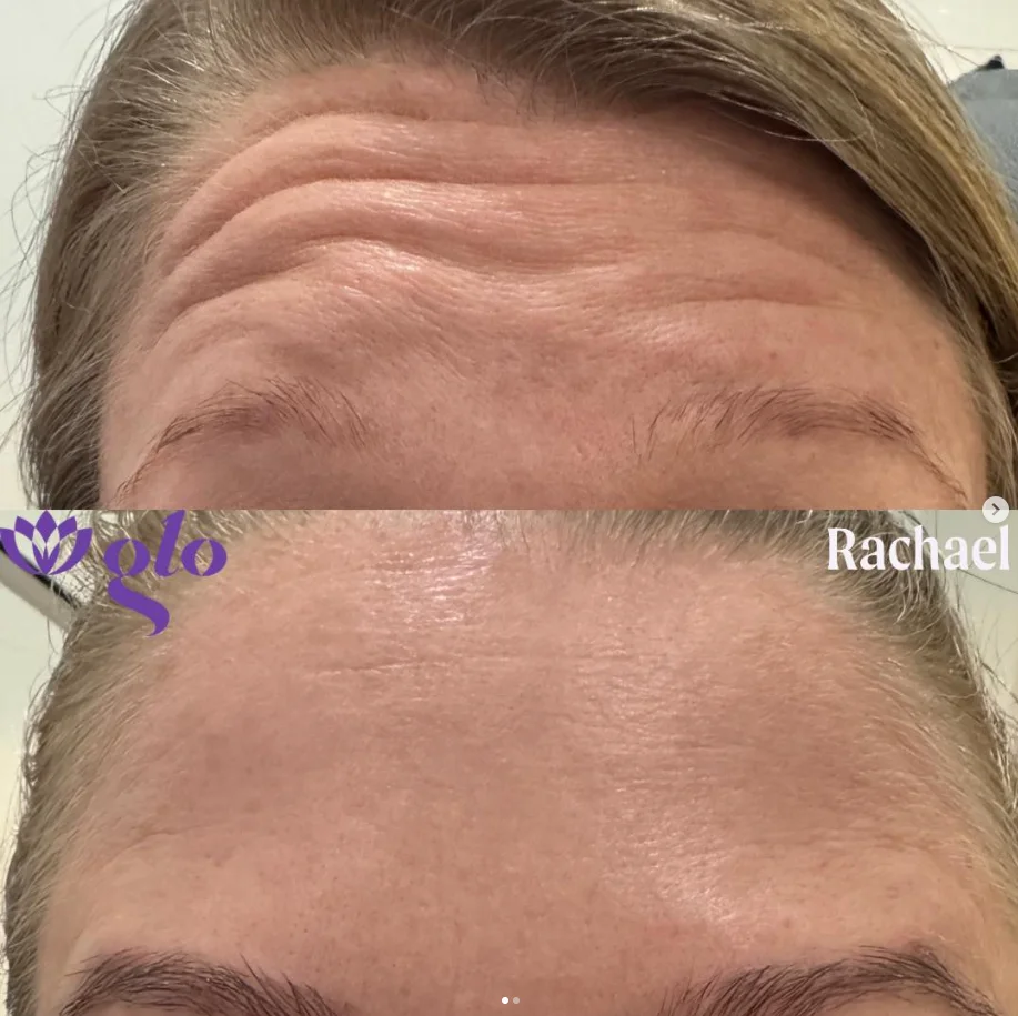 Glo Nail Salon and MedSpa glo nails medspa • Instagram photos and videos 05 20 2025 02 07 PM