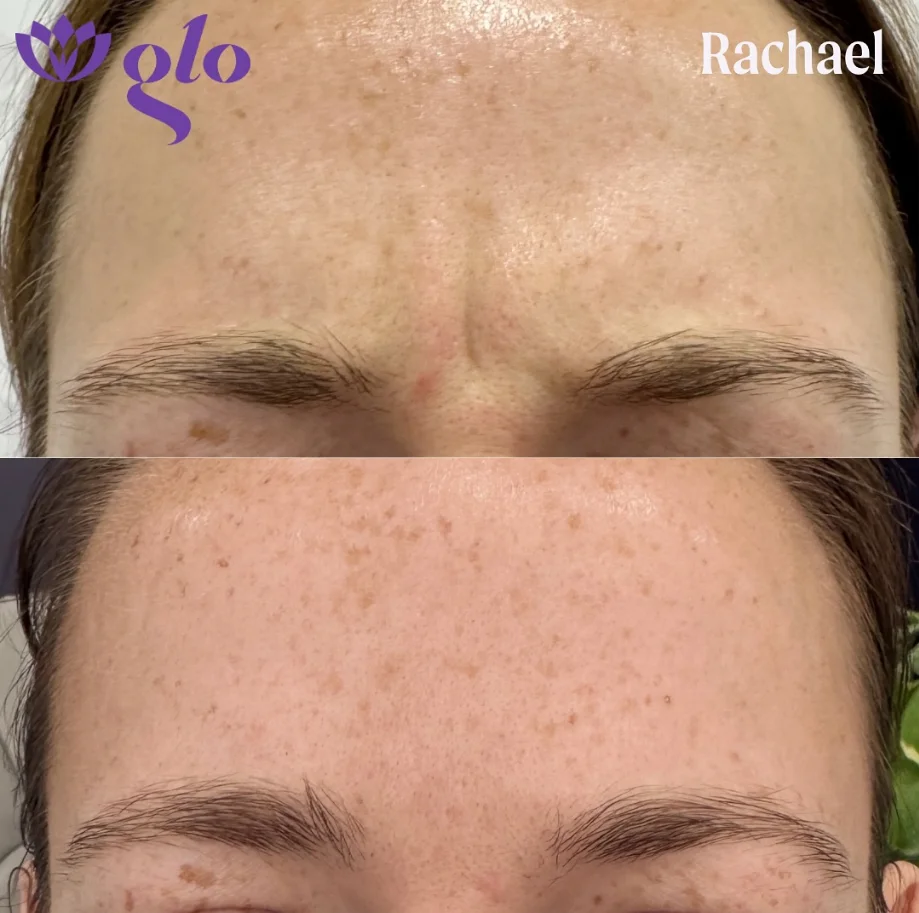 Glo Nail Salon and MedSpa glo nails medspa • Instagram photos and videos 05 20 2025 02 08 PM 1