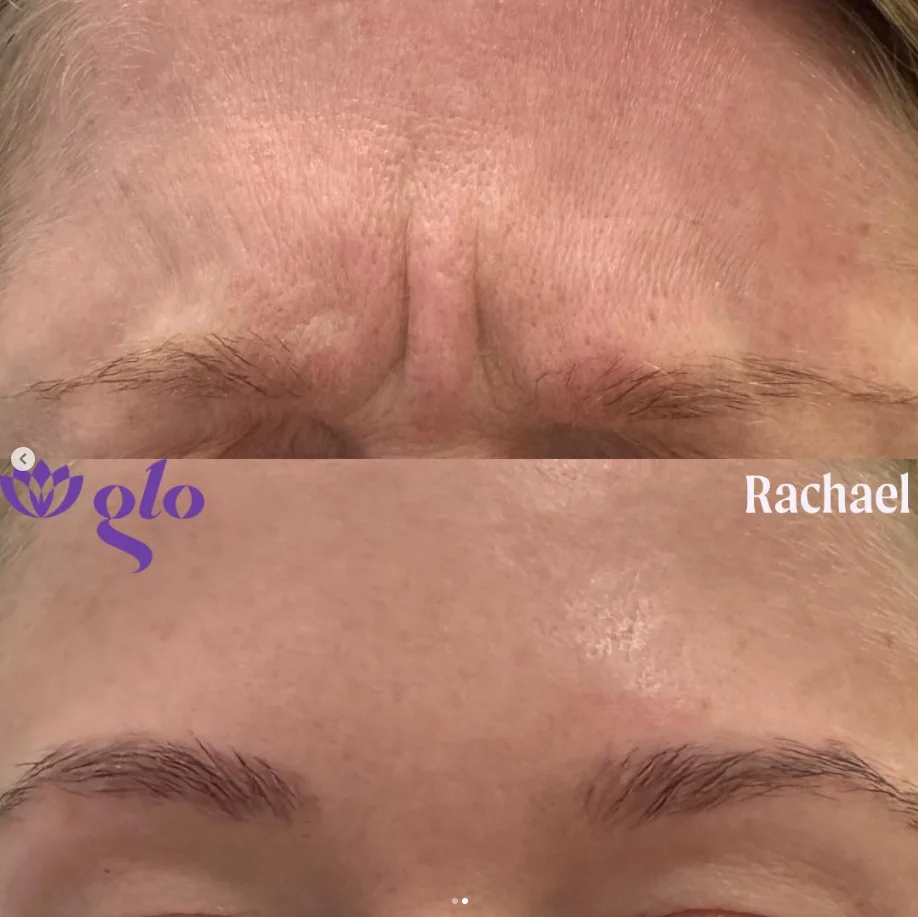 Glo Nail Salon and MedSpa glo nails medspa • Instagram photos and videos 05 20 2025 02 08 PM