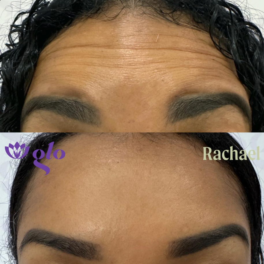 Glo Nail Salon and MedSpa glo nails medspa • Instagram photos and videos 09 15 2025 04 49 PM